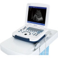 DW-580 ultrasound pregnancy & ultrasound scan machine